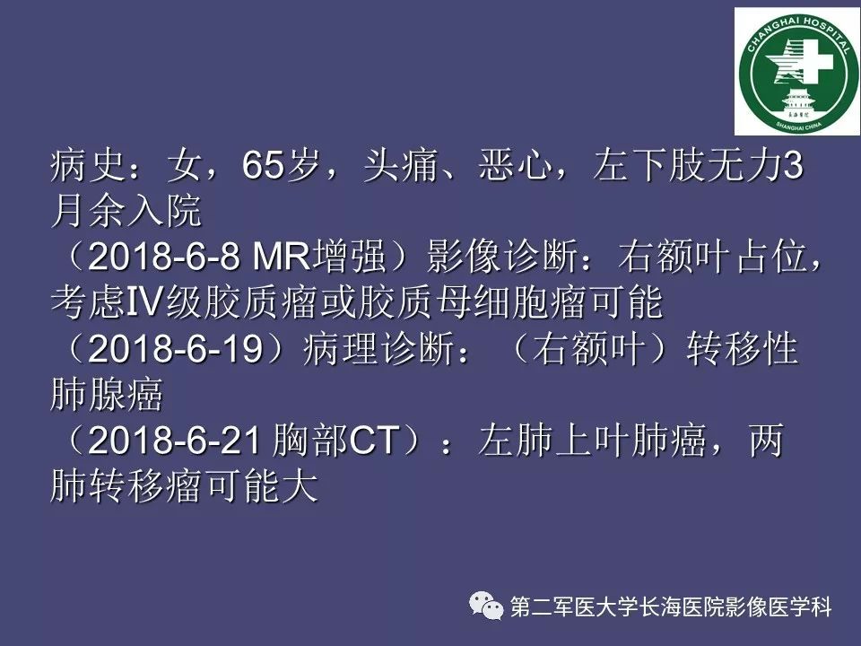 影像PPT - 【PPT】脑内常见环形强化病变的鉴别诊断-81