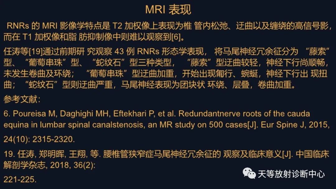 影像PPT - 马尾神经冗余征:马尾神经扭曲-4 影像PPT - 马尾神经冗余征:马尾神经扭曲-4