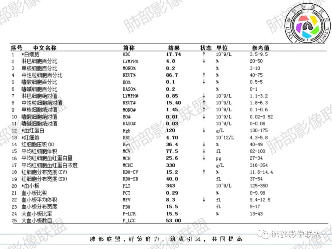 影像PPT - 【病例】诡异的肺部感染—诺卡菌-4 影像PPT - 【病例】诡异的肺部感染—诺卡菌-4
