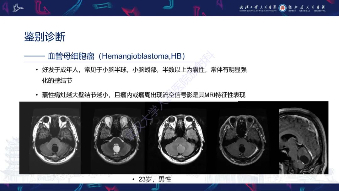 影像PPT - 【PPT】脑节细胞胶质瘤影像诊断-20