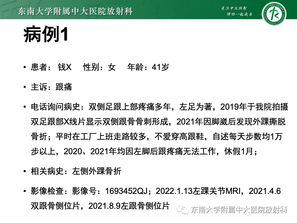 影像PPT - 【PPT】Haglund综合征-2 影像PPT - 【PPT】Haglund综合征-2