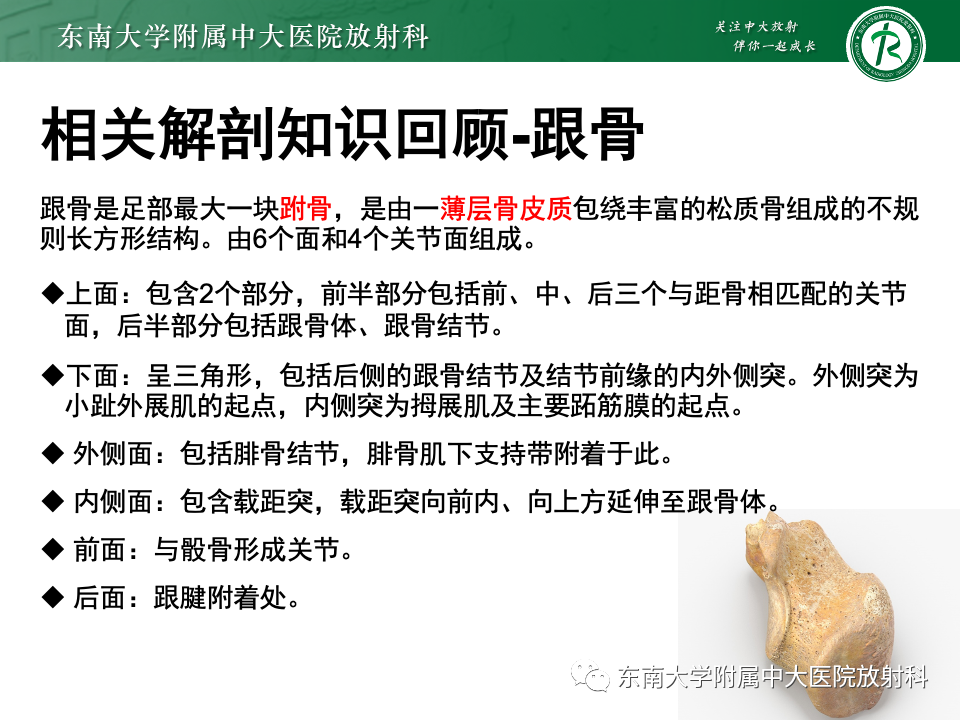 影像PPT - 【PPT】Haglund综合征-9 影像PPT - 【PPT】Haglund综合征-9