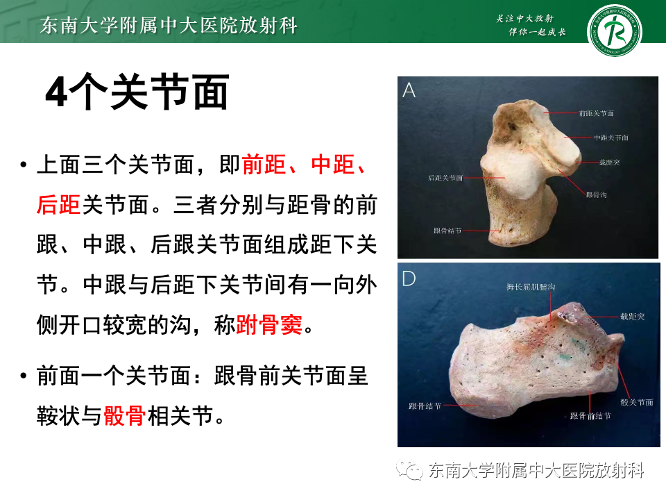 影像PPT - 【PPT】Haglund综合征-11 影像PPT - 【PPT】Haglund综合征-11