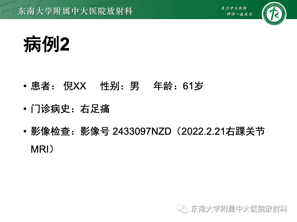 影像PPT - 【PPT】Haglund综合征-36 影像PPT - 【PPT】Haglund综合征-36