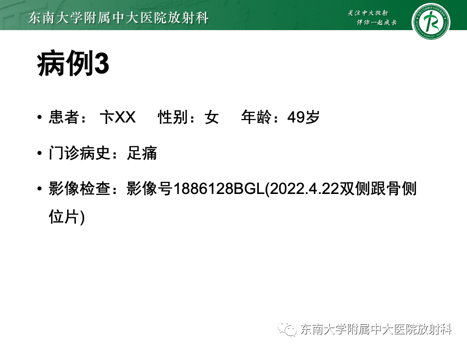 影像PPT - 【PPT】Haglund综合征-38 影像PPT - 【PPT】Haglund综合征-38