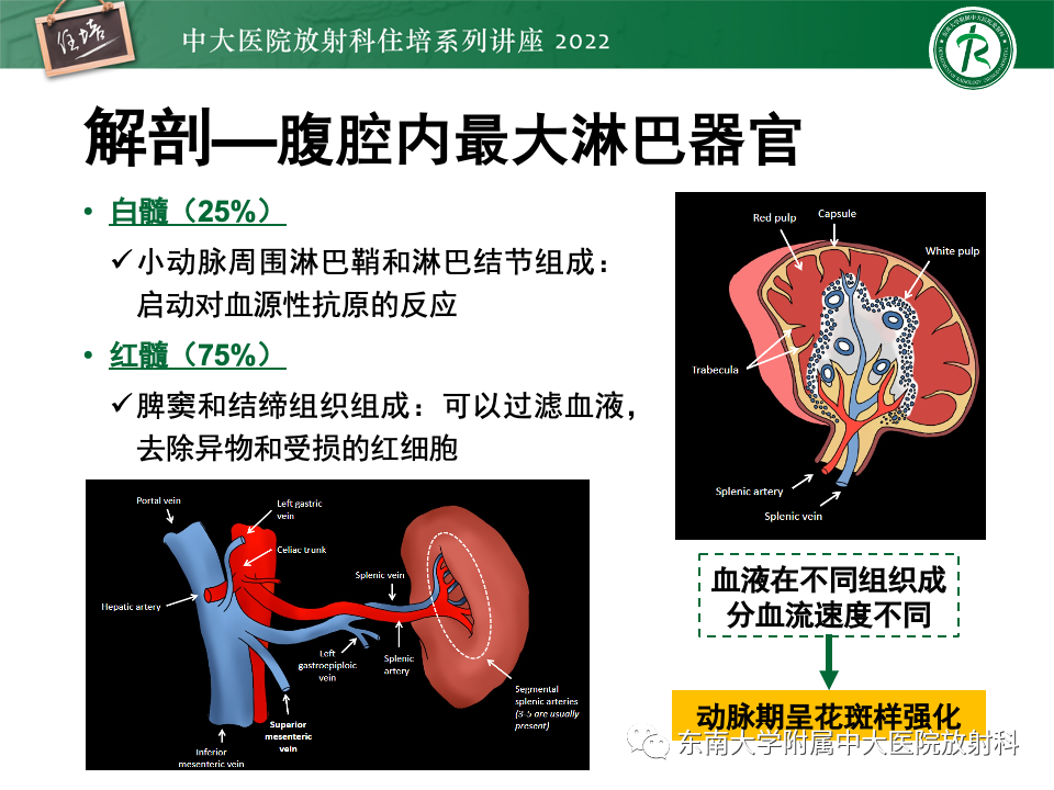 影像PPT - 【PPT】脾脏占位性病变的影像分析-4