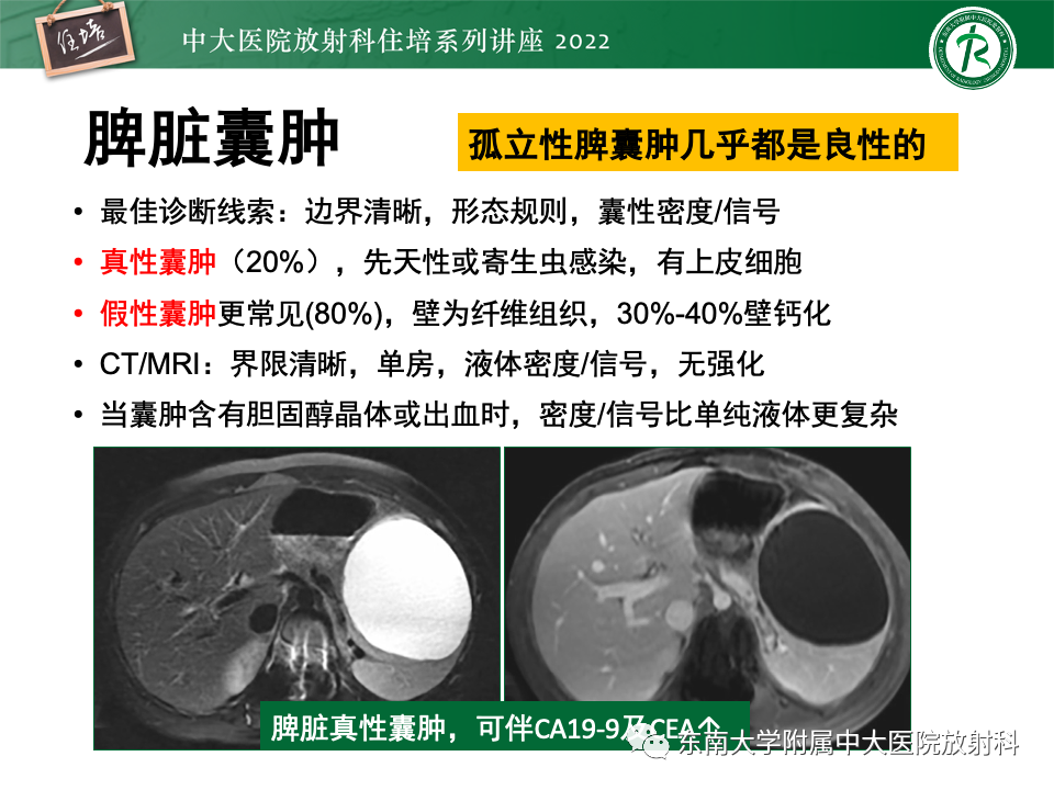 影像PPT - 【PPT】脾脏占位性病变的影像分析-11