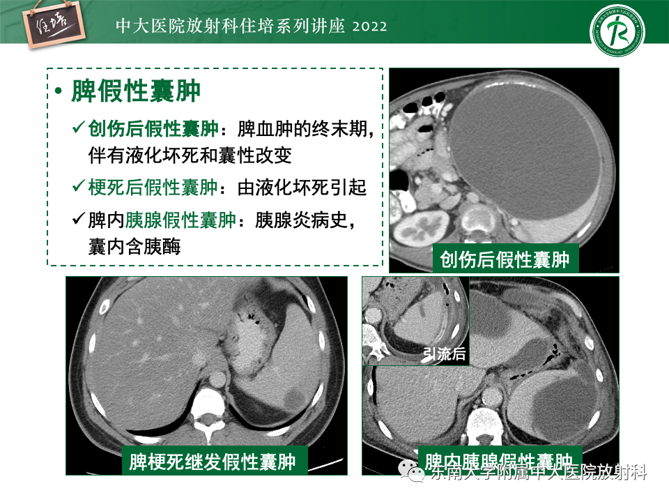 影像PPT - 【PPT】脾脏占位性病变的影像分析-12