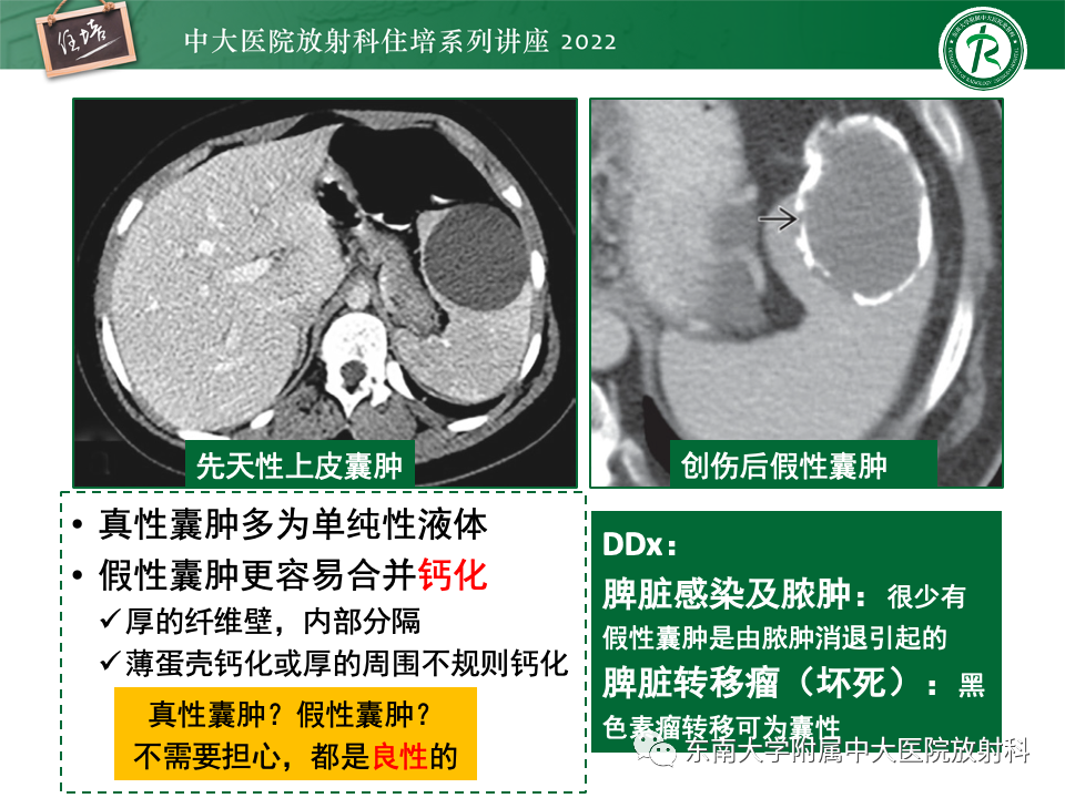 影像PPT - 【PPT】脾脏占位性病变的影像分析-13