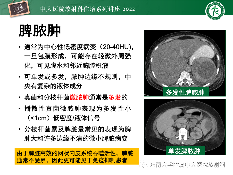 影像PPT - 【PPT】脾脏占位性病变的影像分析-19