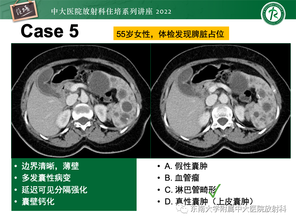 影像PPT - 【PPT】脾脏占位性病变的影像分析-23