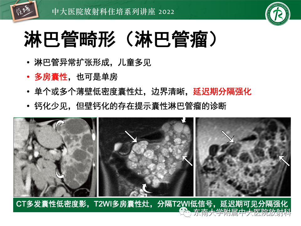 影像PPT - 【PPT】脾脏占位性病变的影像分析-24
