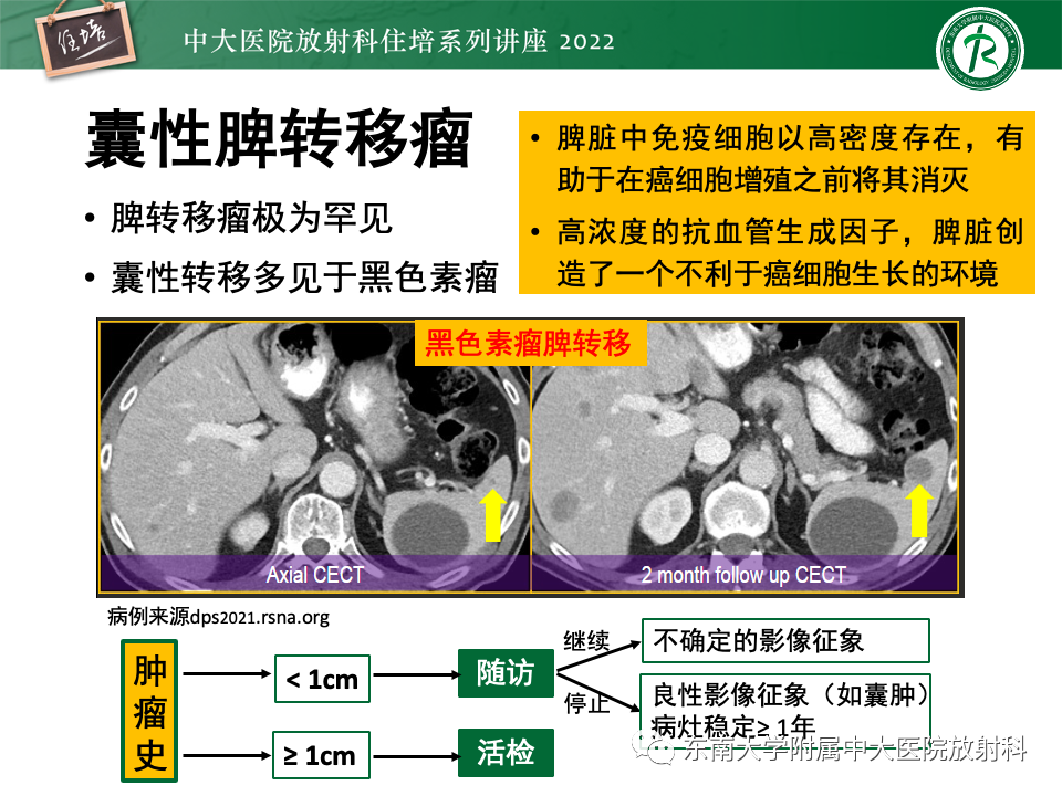 影像PPT - 【PPT】脾脏占位性病变的影像分析-22