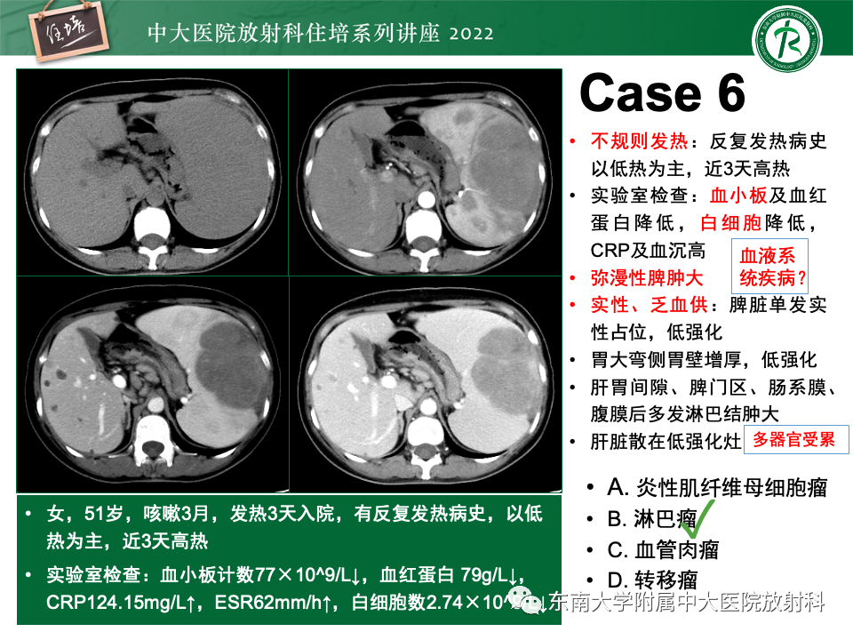 影像PPT - 【PPT】脾脏占位性病变的影像分析-27