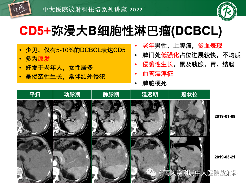影像PPT - 【PPT】脾脏占位性病变的影像分析-32