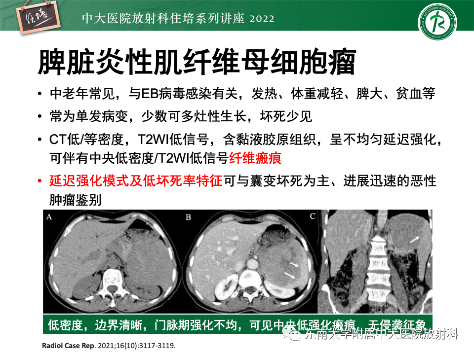影像PPT - 【PPT】脾脏占位性病变的影像分析-33