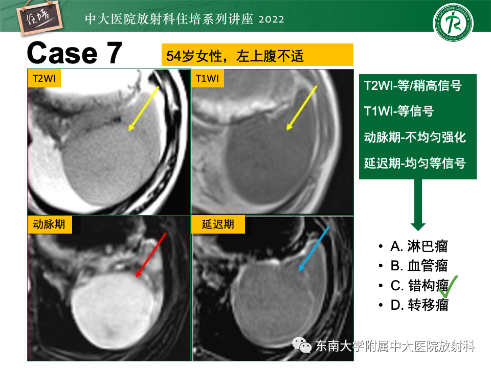影像PPT - 【PPT】脾脏占位性病变的影像分析-35
