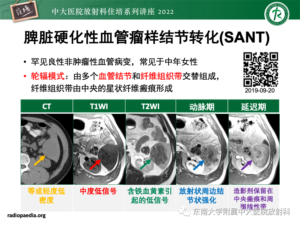 影像PPT - 【PPT】脾脏占位性病变的影像分析-37