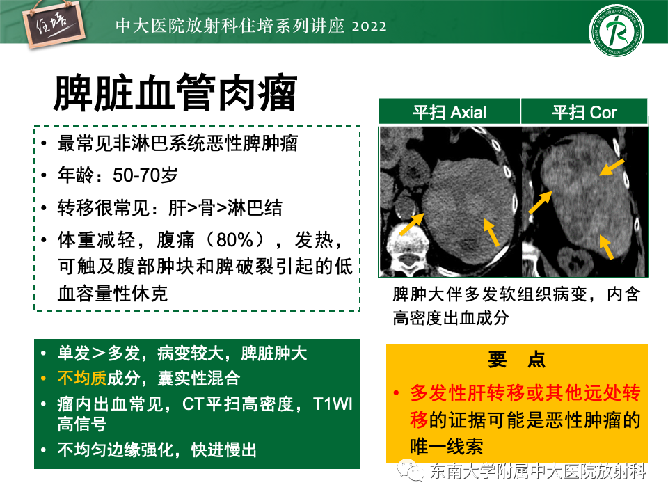 影像PPT - 【PPT】脾脏占位性病变的影像分析-43