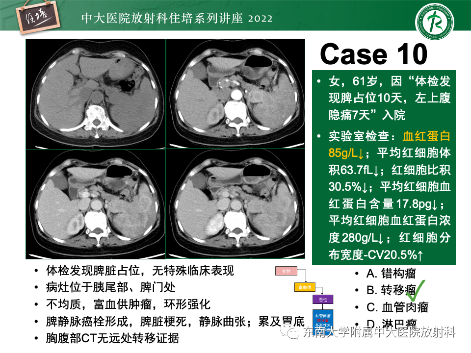 影像PPT - 【PPT】脾脏占位性病变的影像分析-44
