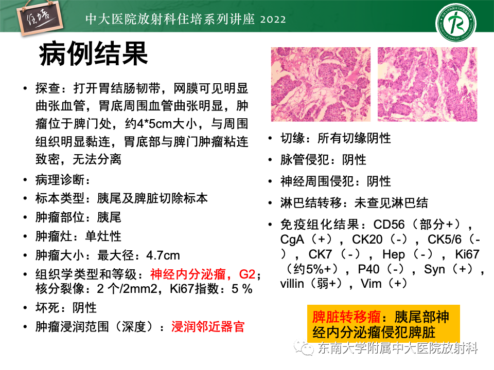 影像PPT - 【PPT】脾脏占位性病变的影像分析-45