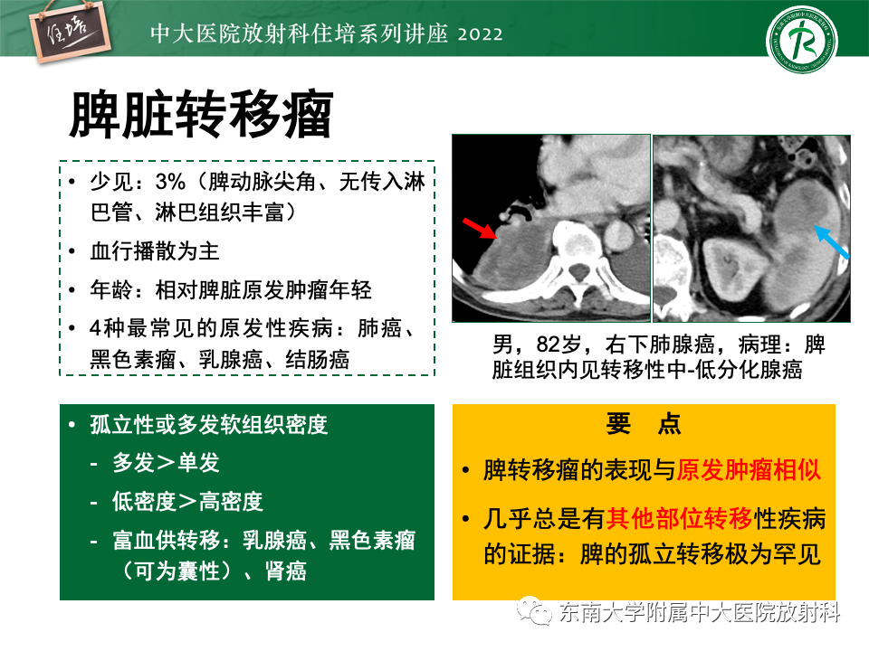 影像PPT - 【PPT】脾脏占位性病变的影像分析-47