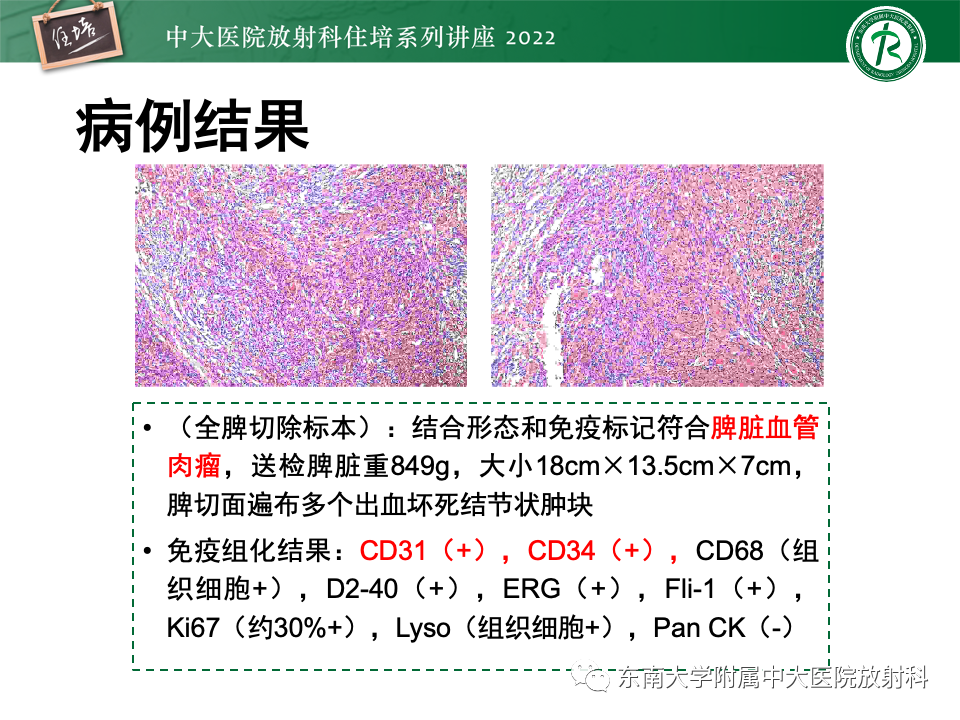 影像PPT - 【PPT】脾脏占位性病变的影像分析-42
