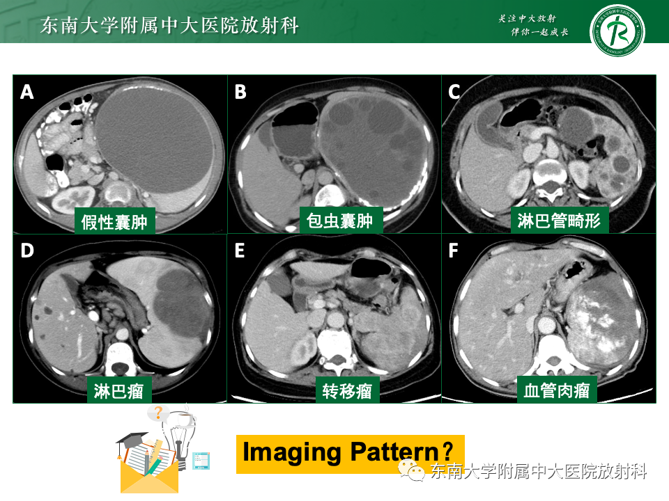 影像PPT - 【PPT】脾脏占位性病变的影像分析-54