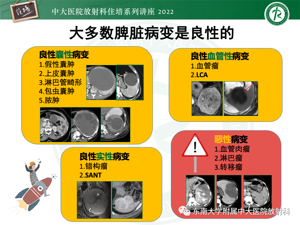 影像PPT - 【PPT】脾脏占位性病变的影像分析-53