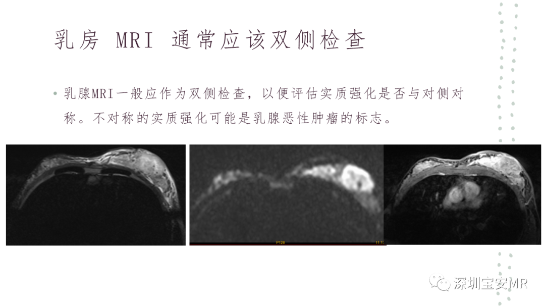 影像PPT - 【PPT】乳腺磁共振科普-32