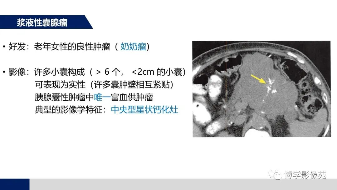 影像PPT - 【PPT】胰腺相关疾病-12