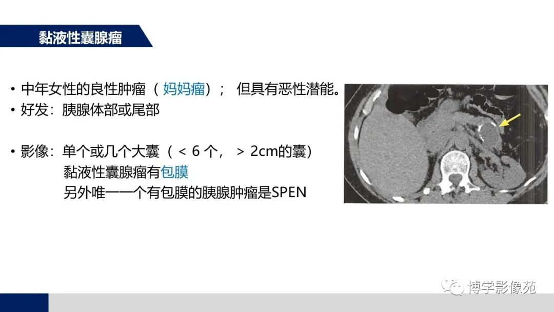 影像PPT - 【PPT】胰腺相关疾病-14