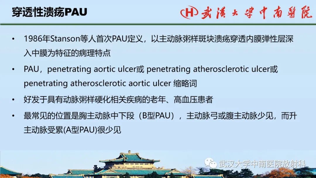 影像PPT - 【PPT】主动脉壁内血肿和穿透性溃疡的影像学诊断-31