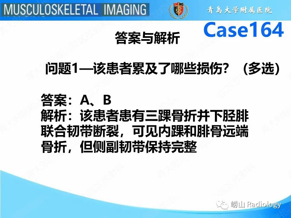 影像PPT - 【PPT】胫腓连结断裂-4