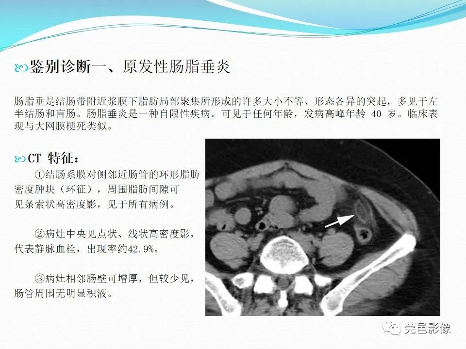 影像PPT - 【PPT】大网膜梗死的CT诊断-26