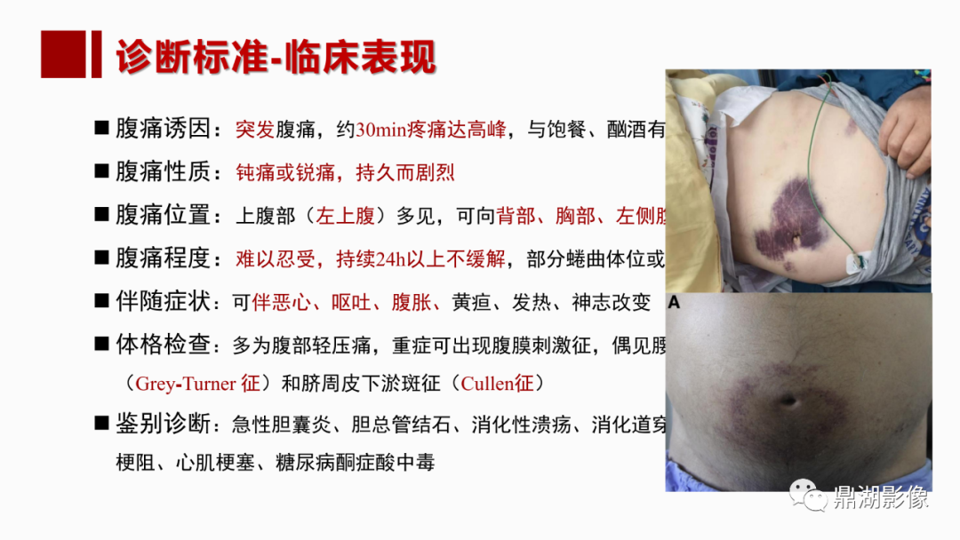 影像PPT - 【PPT】基于修订版亚特兰大急性胰腺炎分类的诊断、临床影像评估及治疗-10