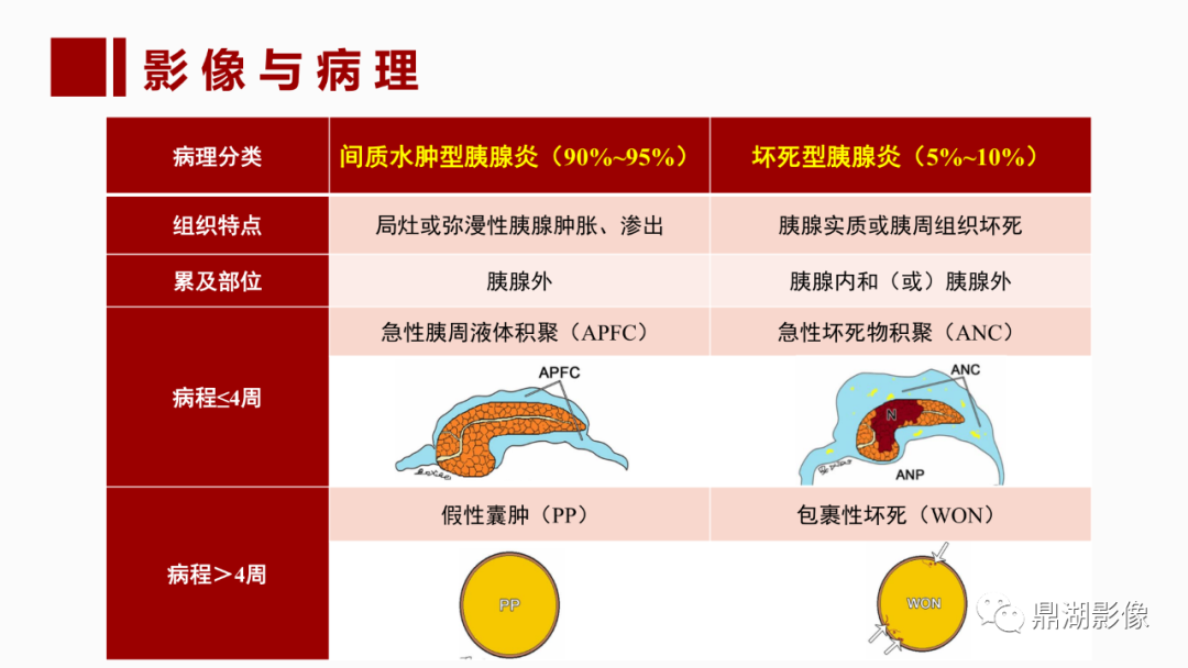 影像PPT - 【PPT】基于修订版亚特兰大急性胰腺炎分类的诊断、临床影像评估及治疗-21