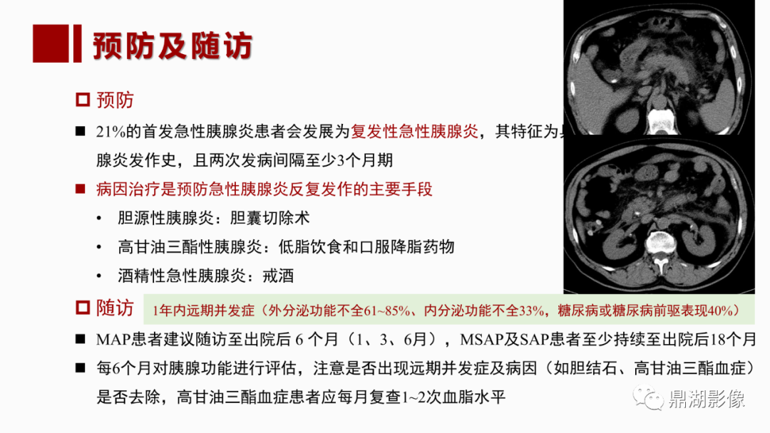 影像PPT - 【PPT】基于修订版亚特兰大急性胰腺炎分类的诊断、临床影像评估及治疗-67