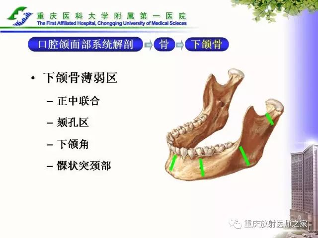 影像PPT - 【PPT】下颌骨解剖及相关疾病影像诊断-5