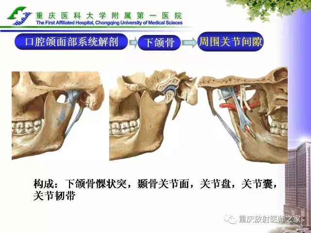 影像PPT - 【PPT】下颌骨解剖及相关疾病影像诊断-7