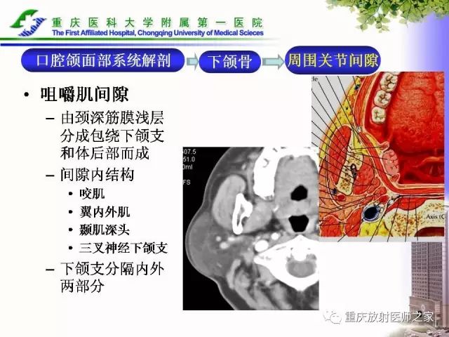 影像PPT - 【PPT】下颌骨解剖及相关疾病影像诊断-8