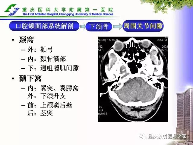 影像PPT - 【PPT】下颌骨解剖及相关疾病影像诊断-10