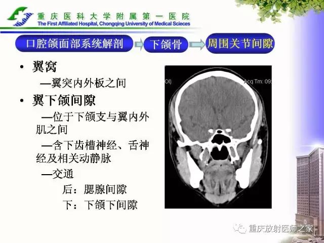 影像PPT - 【PPT】下颌骨解剖及相关疾病影像诊断-11
