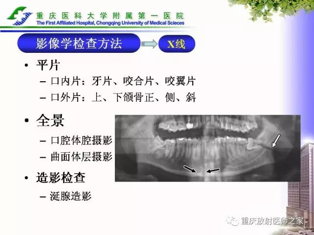 影像PPT - 【PPT】下颌骨解剖及相关疾病影像诊断-22