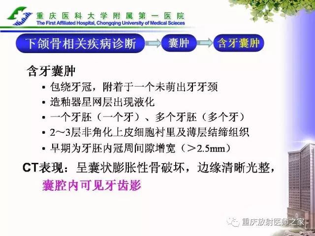 影像PPT - 【PPT】下颌骨解剖及相关疾病影像诊断-52