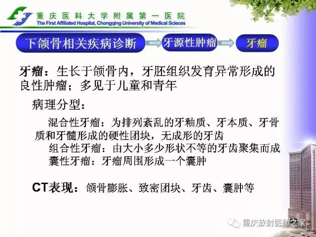 影像PPT - 【PPT】下颌骨解剖及相关疾病影像诊断-59