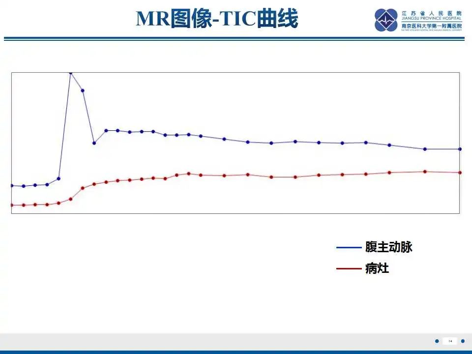 影像PPT - 【PPT】腹腔里的“三明治”—肠系膜淋巴瘤-15
