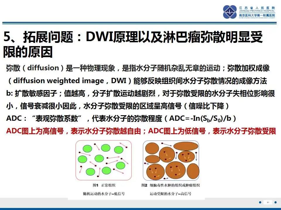 影像PPT - 【PPT】腹腔里的“三明治”—肠系膜淋巴瘤-32