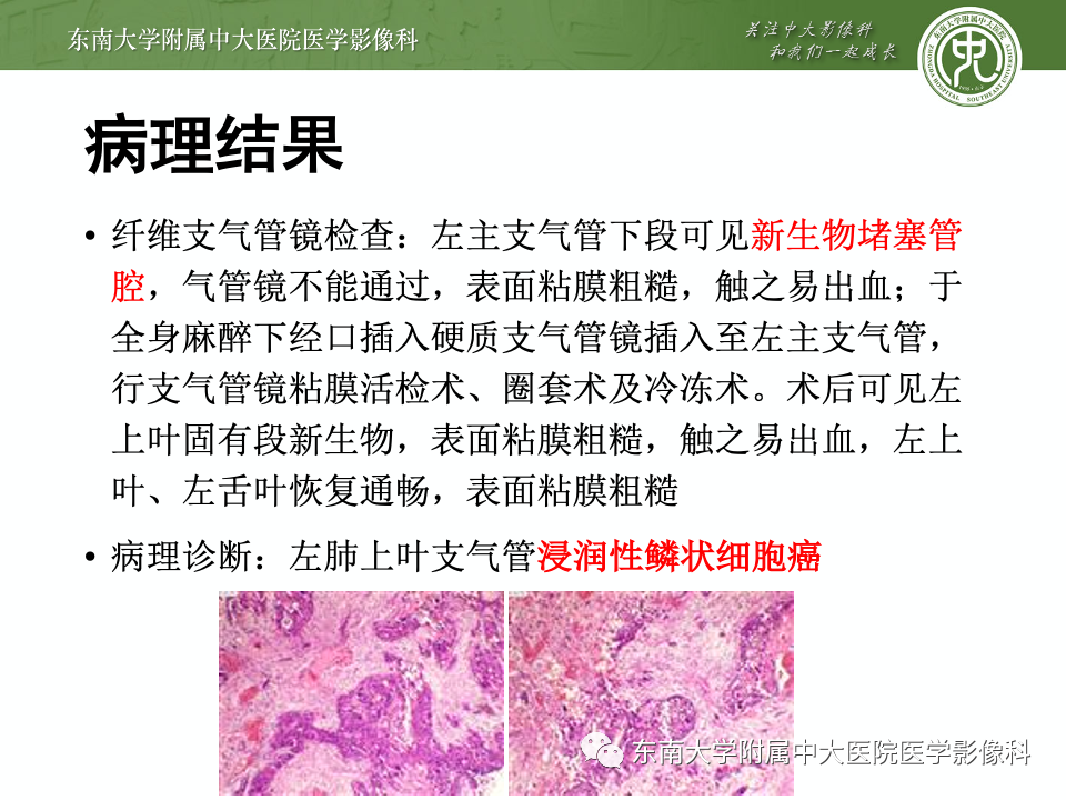 影像PPT - 【PPT】指套征相关病变诊断与鉴别-5 影像PPT - 【PPT】指套征相关病变诊断与鉴别-5