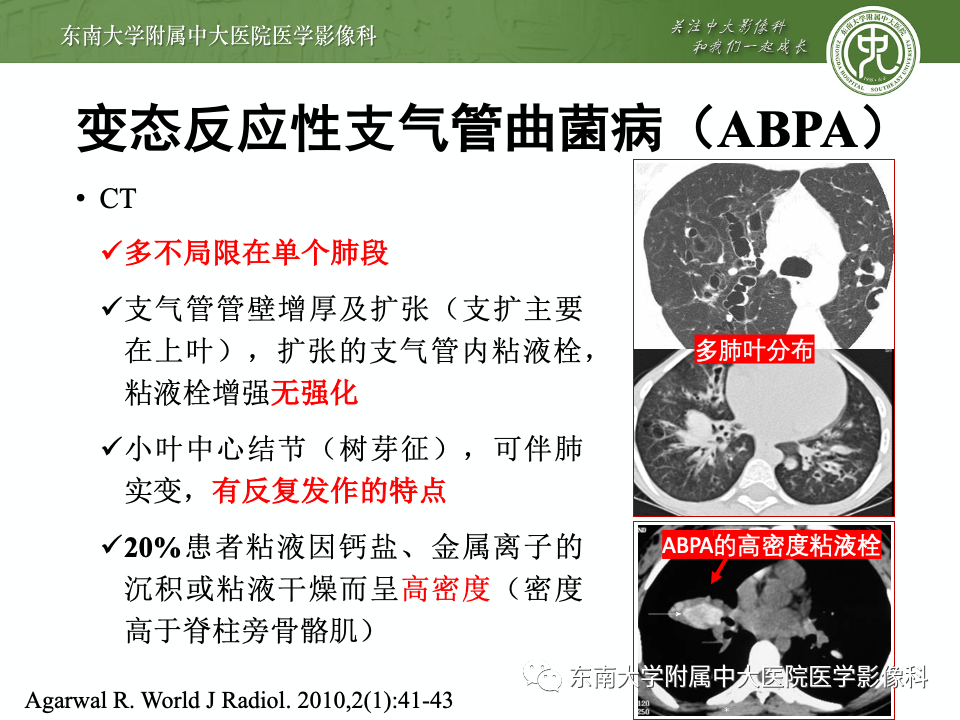 影像PPT - 【PPT】指套征相关病变诊断与鉴别-16 影像PPT - 【PPT】指套征相关病变诊断与鉴别-16